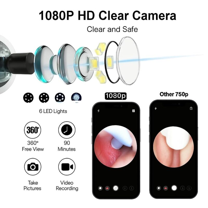 Zilotyshopping Wireless Ear Cleaning Endoscope Kit with HD Camera, WiFi Connection & 6 LED Lights – Smart Otoscope Earwax Removal Tool Set of 8 for Kids, Adults & Family Use – Compatible with iOS & Android - Image 5